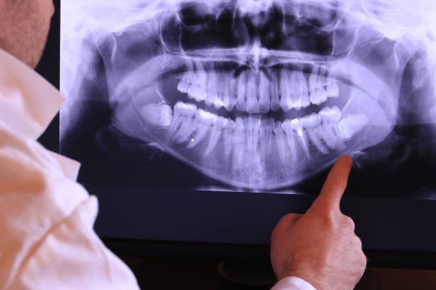 Best Weekend Emergency Dentist in Branchville, SC
