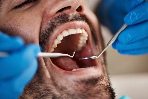 Best Emergency Treatment for Dental Infections or Abscesses in Branchville, SC